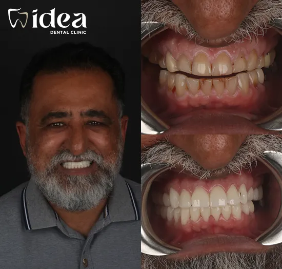 Before & After 10